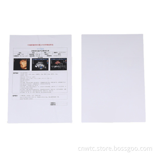Double-Sided White Medical Laser Film for Ultrasound Imaging and Inkjet Printing